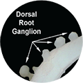 dorsal root ganglion